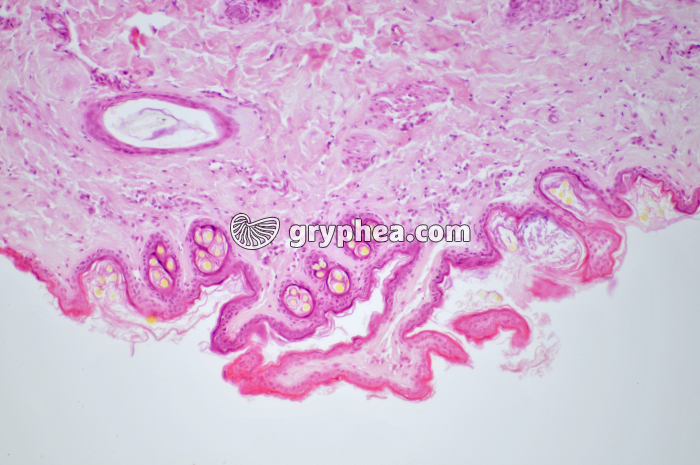 Glande mammaire inactive CT x40 - gryphea.com